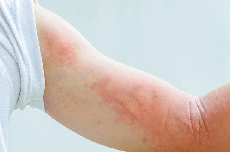 Bệnh sán chó: Dấu hiệu, Hình ảnh sán chó & Cách trị, Phòng ngừa (3)