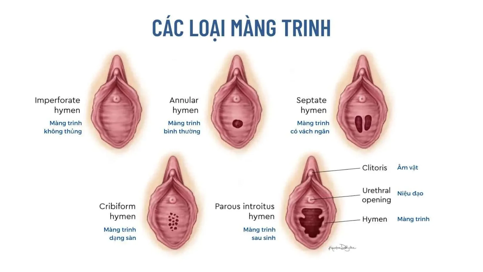 Cấu tạo bộ phận sinh dục nữ 3D: Màng trinh